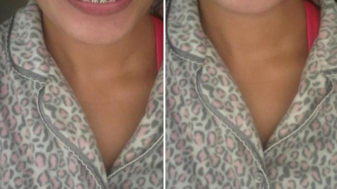 Better picture: Do I look like I still need braces?