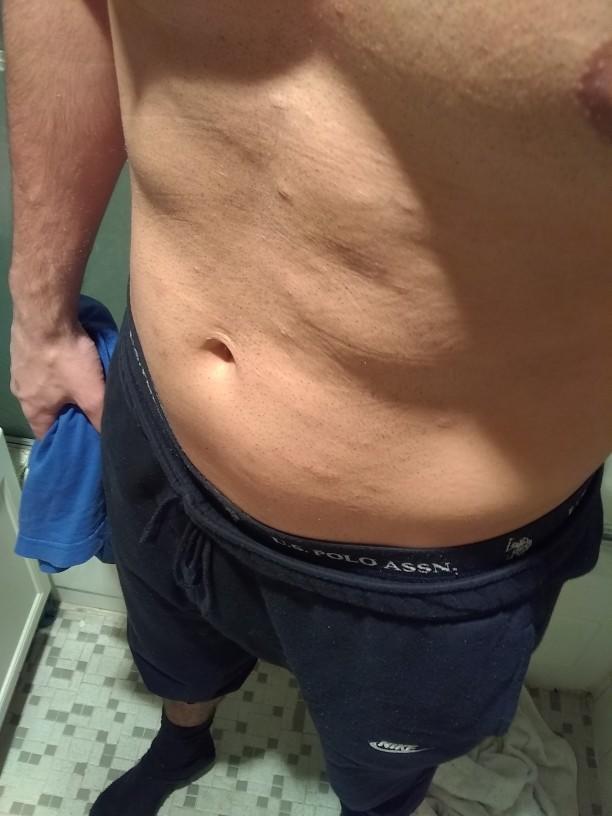 Chest and stomach hair on guys?