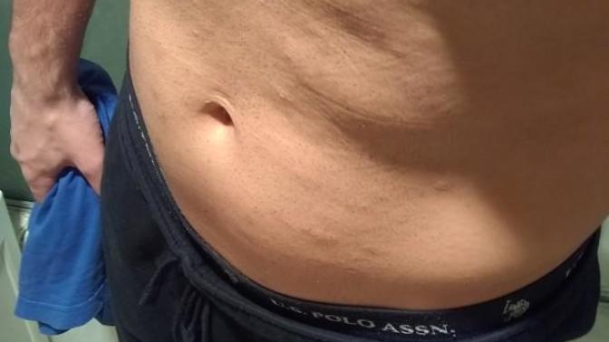 Chest and stomach hair on guys?