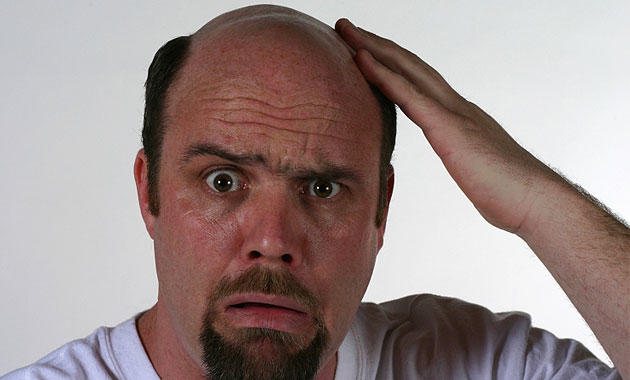 Bald/balding guys, how were you able to come to terms with the unfortunate truth that you were losing your hair?