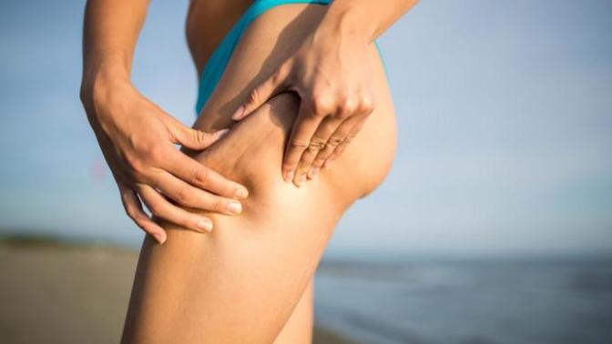 Has any one tried any method to get rid of cellulite?
