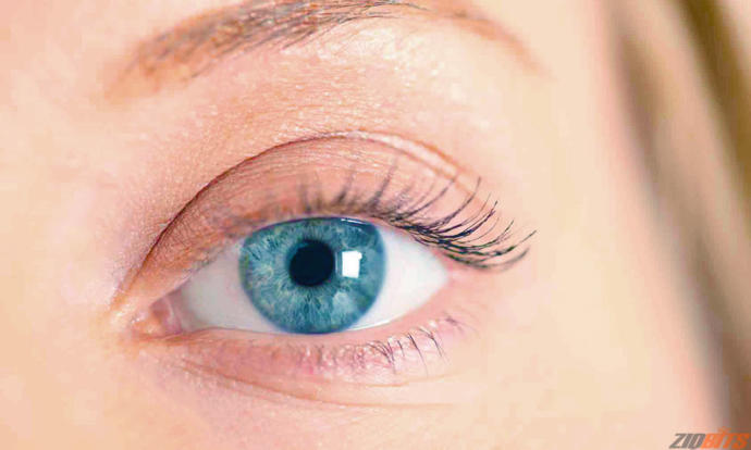 Do you like dark limbal rings?