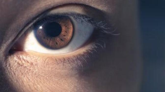 Do you like dark limbal rings?