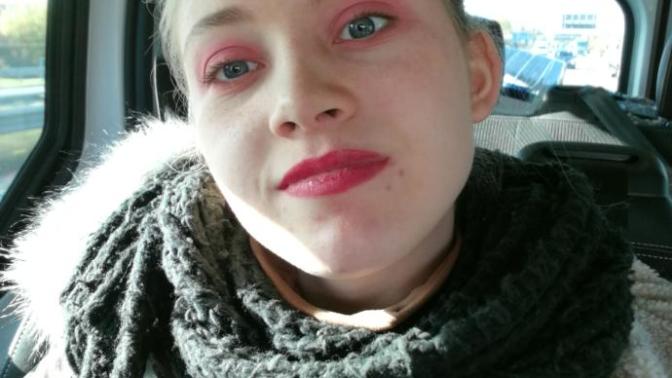 Anybody else dealing with having a baby face? What are your experiences?