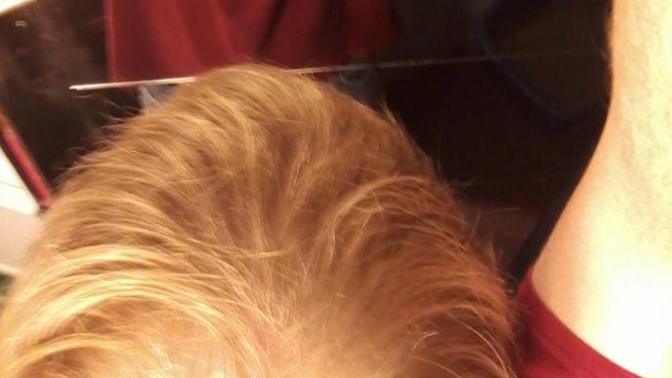 Am I going bald?