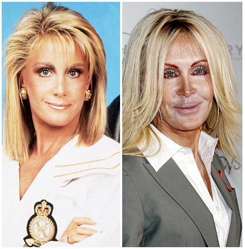 Which attractive Celebrity has destroyed their good looks with plastic surgery?