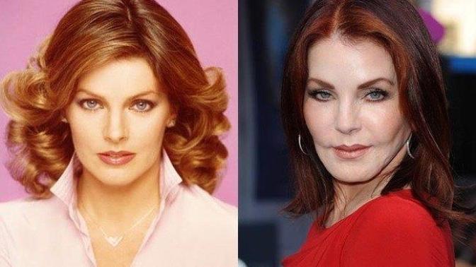 Which attractive Celebrity has destroyed their good looks with plastic surgery?