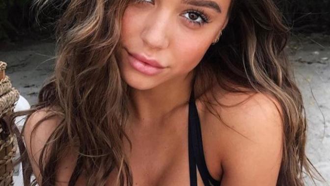 What do guys think of big lips and lip injections? Sexy or turn off?