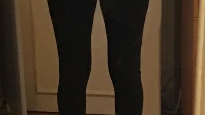 Are my legs really weird?
