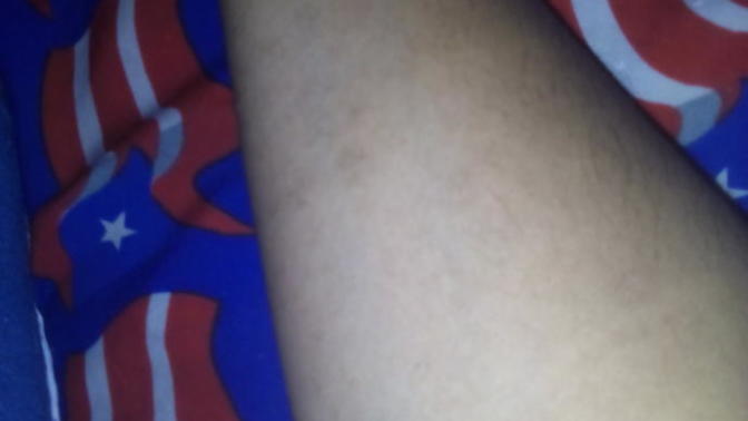 Do you have a birthmark? If so, where?