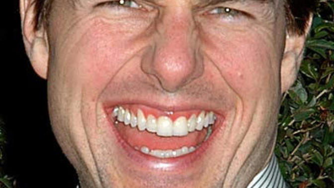 Would you date someone with bad crooked teeth?