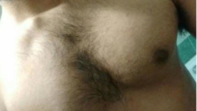 Wtf my guy friend just had breast implants. What are your thoughts?