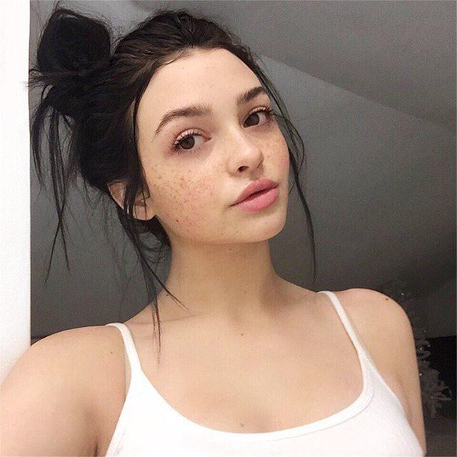 Are freckles cute or not?