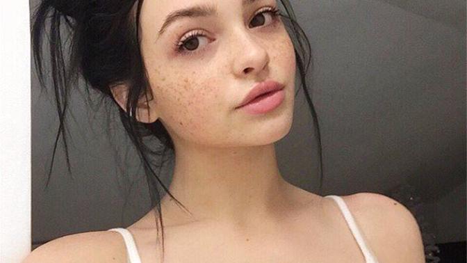 Are freckles cute or not?