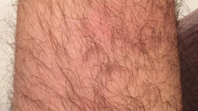 Hows ma hairy leg?