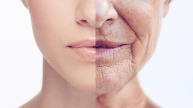 Do women age faster than men appearance wise?