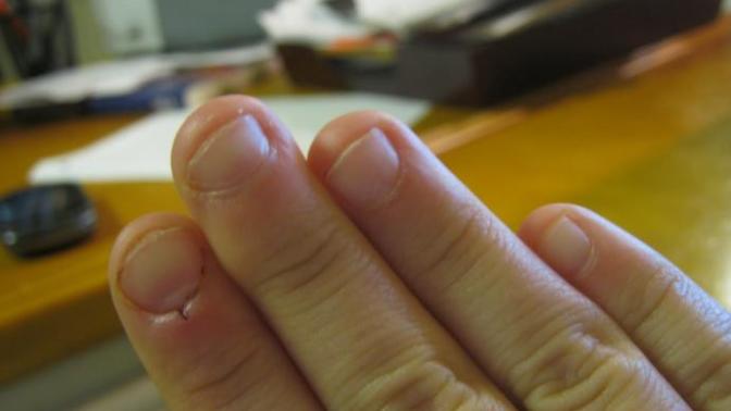 I have short ugly stubby nails?