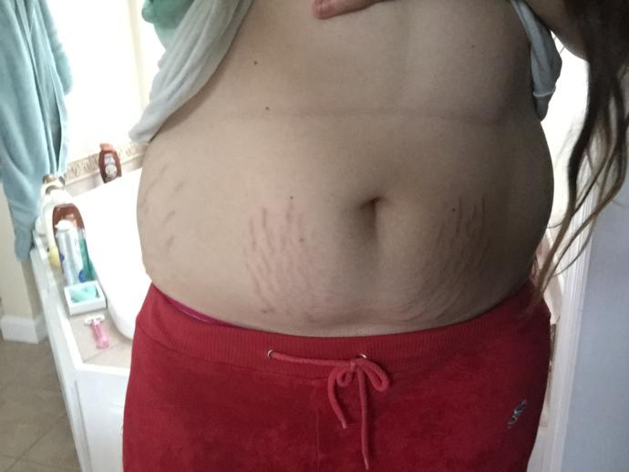 Do you think I should wear a low or high waisted bikini? I have bad stretch marks and a muffin top? Going to Disney?