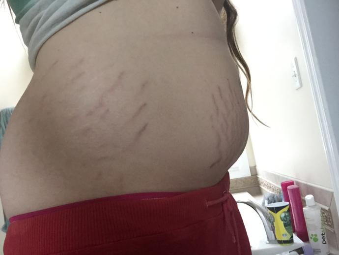 Do you think I should wear a low or high waisted bikini? I have bad stretch marks and a muffin top? Going to Disney?