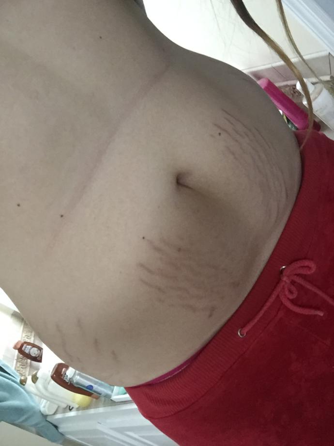 Do you think I should wear a low or high waisted bikini? I have bad stretch marks and a muffin top? Going to Disney?