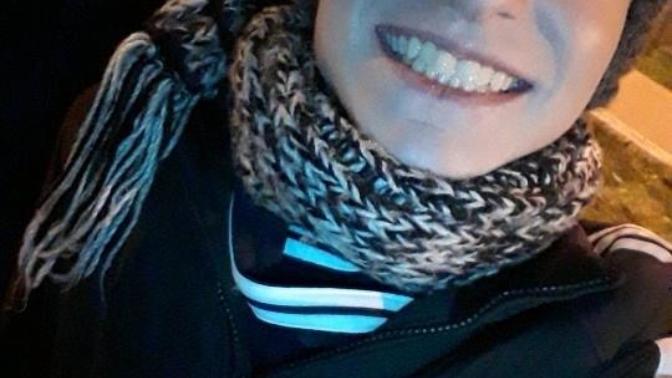 Do I have bad teeths?
