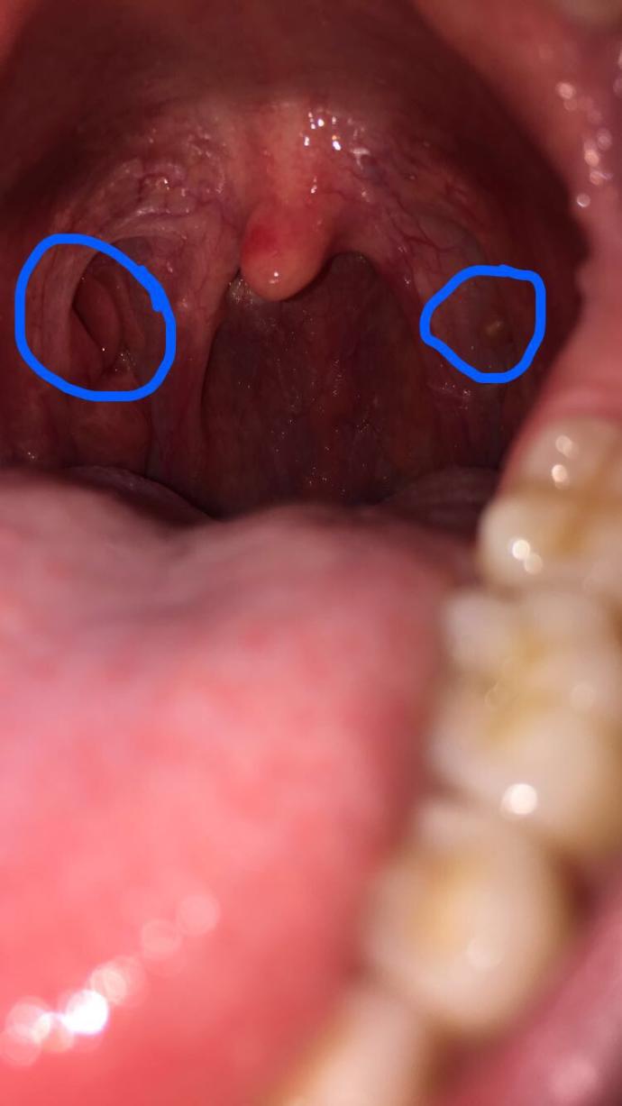 What’s this stuff in my mouth?