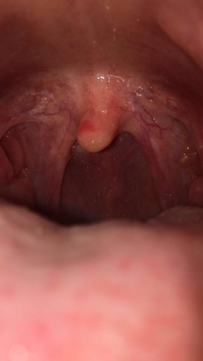 What’s this stuff in my mouth?