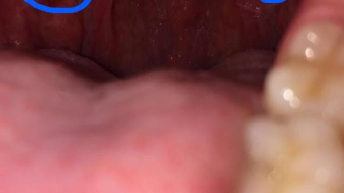 What’s this stuff in my mouth?