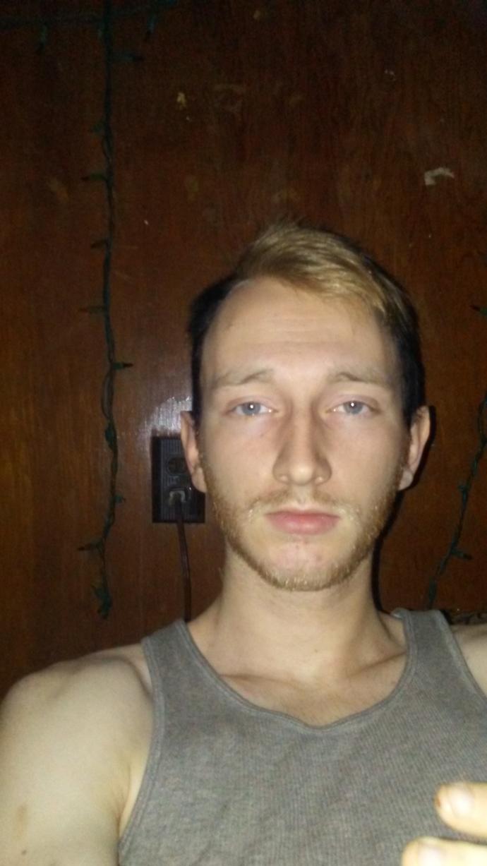 Does my big forehead make me unattractive?