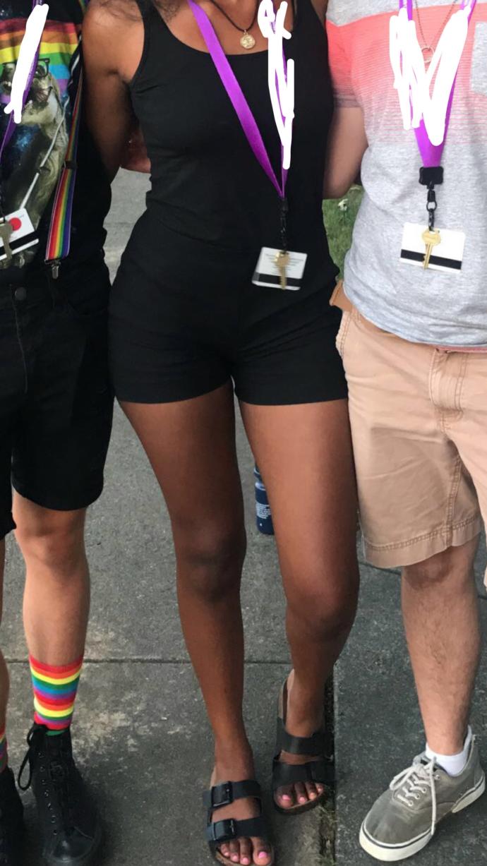 Guys, do you notice “knock knees” in girls?