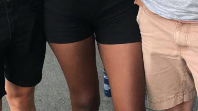 Guys, do you notice “knock knees” in girls?