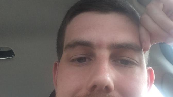 Are my teeth too crooked and unattractive? Should I try to fix it?