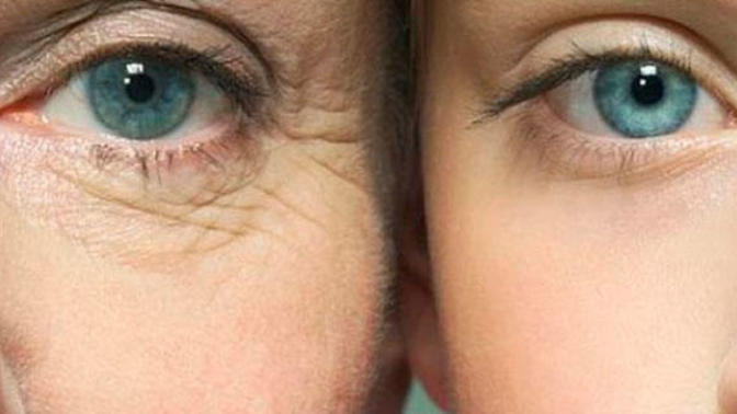 Guys, are wrinkles around the eyes unattractive?