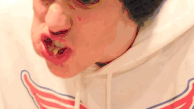 Do you chew with your mouth open?