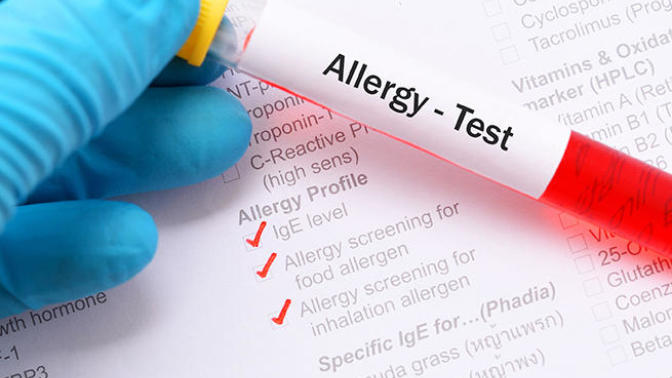 How do you know if you are allergic to something or just have an intolerance?
