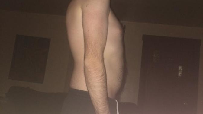 How bad is my posture? What are some solutions? Can lifting weights help?