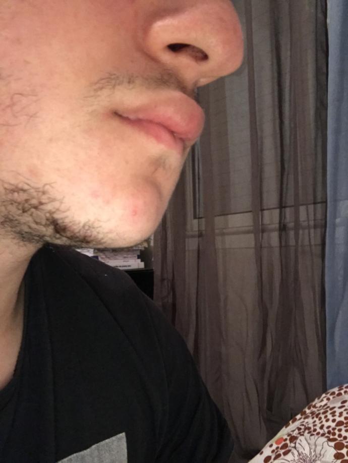 Girls, My girlfriend says I have nice lips I never thought they were special kinda felt nice what do u think sorry for the ugly close ups of my facial hair?