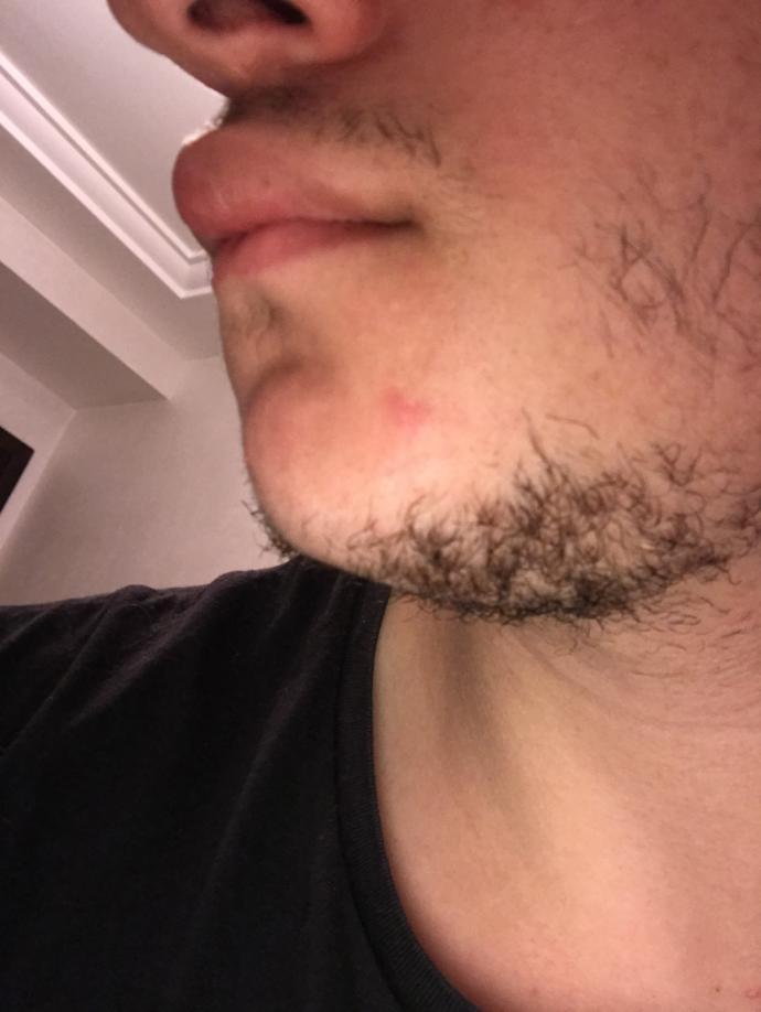 Girls, My girlfriend says i have nice lips i never thought they were special kinda felt nice what do u think sorry for the ugly close ups of my facial hair ?