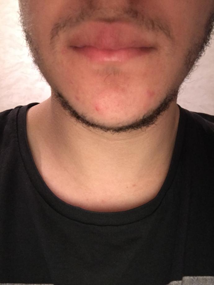 Girls, My girlfriend says I have nice lips I never thought they were special kinda felt nice what do u think sorry for the ugly close ups of my facial hair?