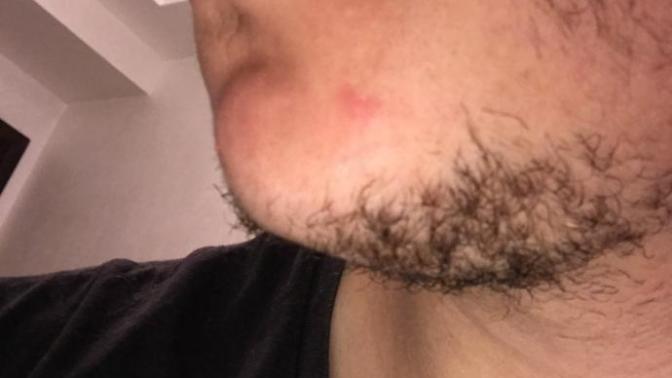 Girls, My girlfriend says I have nice lips I never thought they were special kinda felt nice what do u think sorry for the ugly close ups of my facial hair?