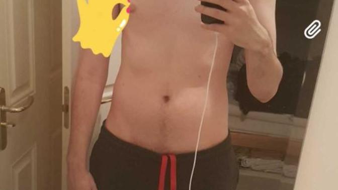Recovering anorexic guy wants your opinion... how do I look?