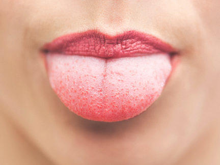 How often do you Bite your Tongue by mistake?