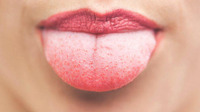 How often do you Bite your Tongue by mistake?