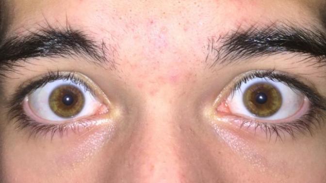 Most attractive hair and eye combination?