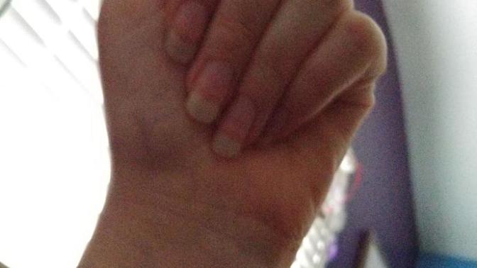 Should I cut my nails?
