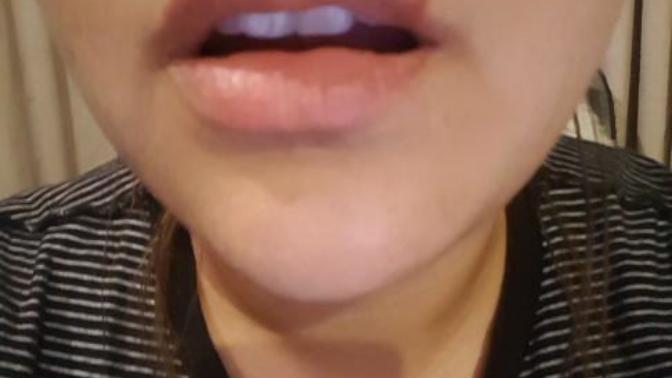 Is this a cold sore and how do I treat it?