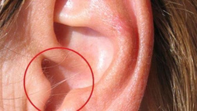EAR HAIR - How do other people deal with this problematic issue?
