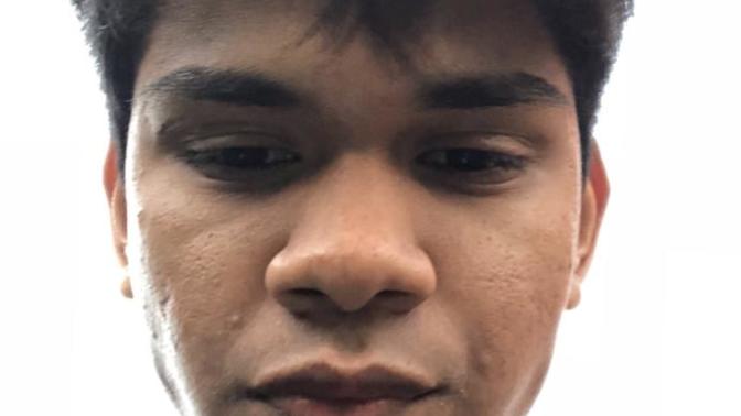 I have some acne/scars. Is it bad?