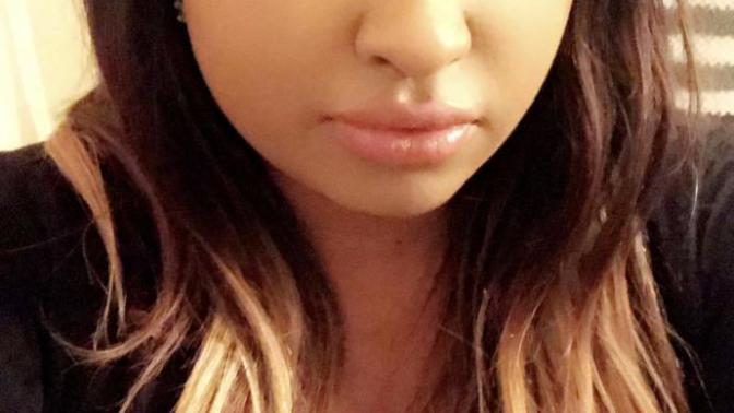 Why does everyone keep looking/staring at me is there something wrong with the way I look (read details please)?