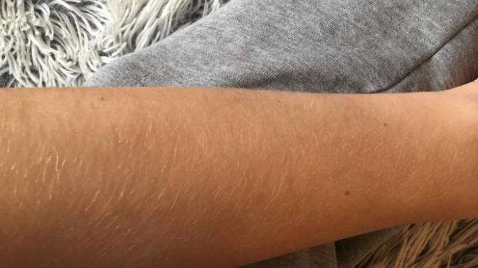 Should girl shave the hair on their arms?